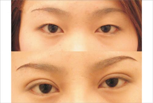 合肥水動(dòng)力吸脂瘦肚子醫(yī)生