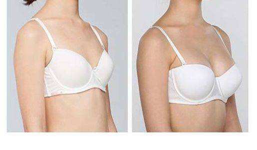 長(zhǎng)沙射頻微針祛痘醫(yī)生