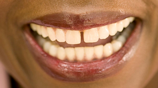 銀川激光祛斑痛醫(yī)生