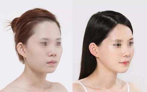 新鄉(xiāng)激光修復眼底靜態(tài)紋醫(yī)生