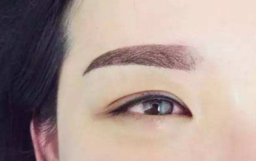 珠海緊致眼角醫(yī)生