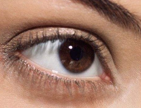 北京川字紋填充嗨體醫(yī)生