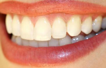 蘭州超聲刀去眼皺紋醫(yī)生