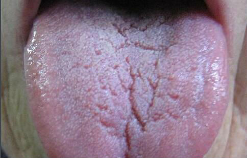 深圳磨顴骨術(shù)醫(yī)生