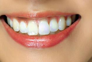 杭州光纖溶脂祛唇紋醫(yī)生