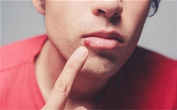 石家莊做c8激光祛斑醫(yī)生