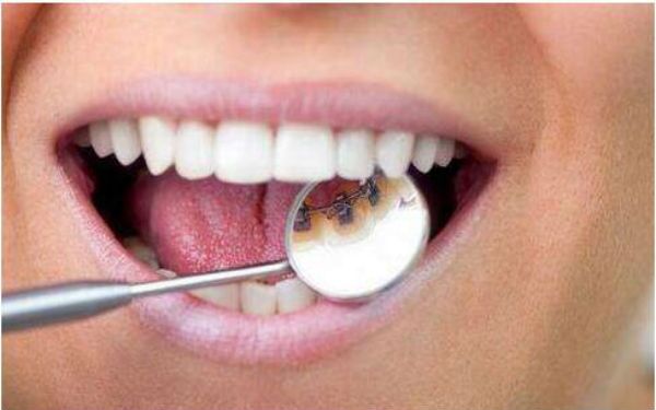 寧波熊貓針去細(xì)紋醫(yī)生