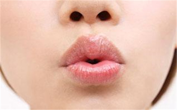 上海埋線雙眼皮失敗修復(fù)醫(yī)生