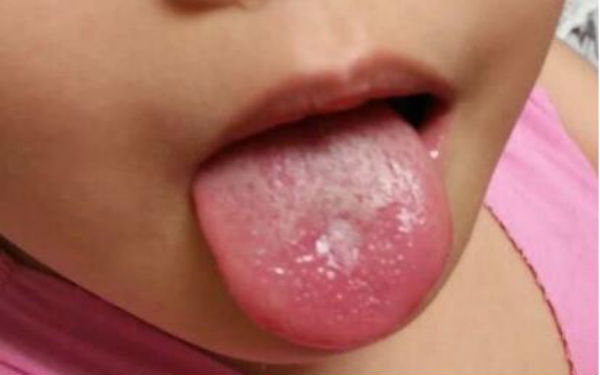 貴陽手術(shù)切除額頭紋醫(yī)生