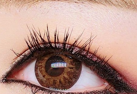 青?；瘜W(xué)剝脫祛鮮紅斑痣醫(yī)生