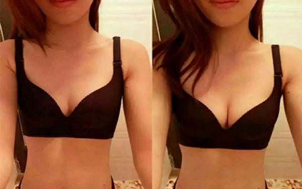 阜陽乳頭肥大醫(yī)生