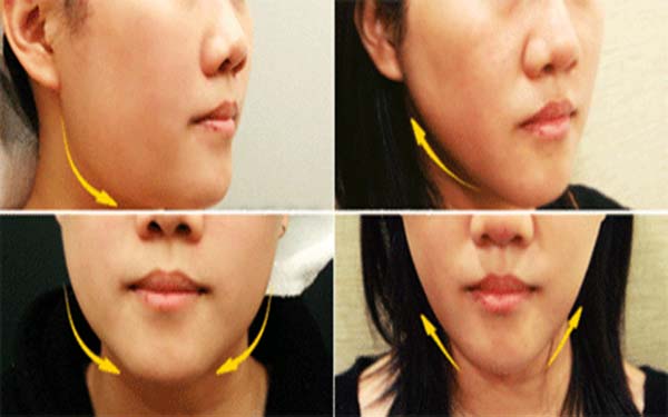 石家莊動(dòng)態(tài)細(xì)紋注射填充醫(yī)生