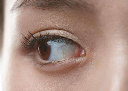 江門整容祛疤醫(yī)生