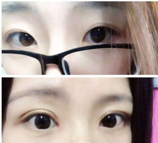 濟(jì)南非手術(shù)面部特征雕刻醫(yī)生