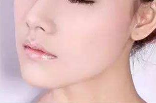 石家莊超聲炮去眉間紋醫(yī)生