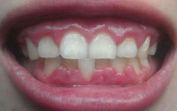 南京抽脂雙下巴醫(yī)生