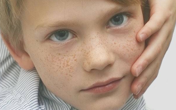 上海下眼皮皺紋注射玻尿酸醫(yī)生