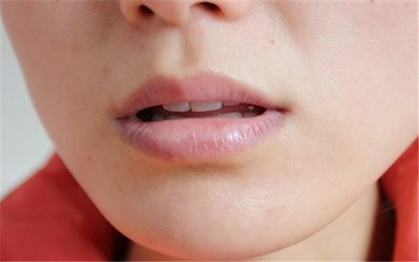 北京激光除動態(tài)細(xì)紋醫(yī)生