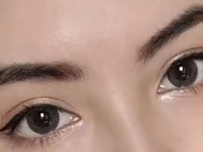 上海強脈沖光緊膚除皺醫(yī)生