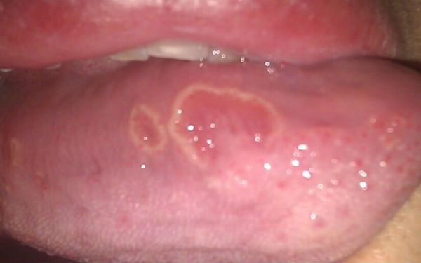 洛陽(yáng)自體脂肪注射眉間紋醫(yī)生