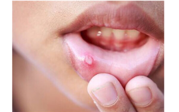 攀枝花點陣祛魚尾紋醫(yī)生