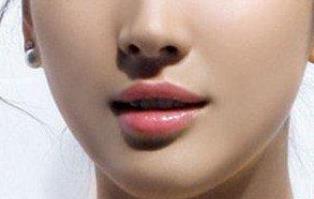 東莞祛動態(tài)細(xì)紋手術(shù)醫(yī)生