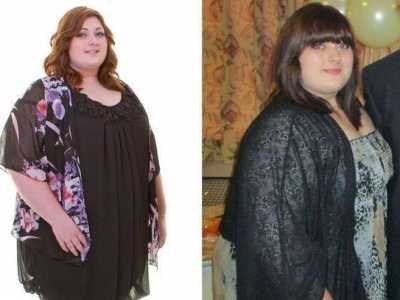 長沙抬頭紋填充醫(yī)生