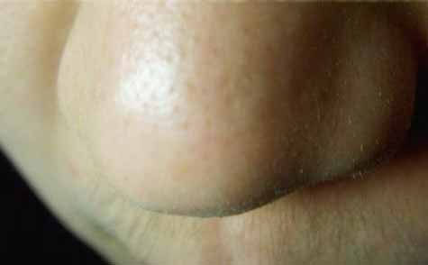 長春假體墊鼻基醫(yī)生