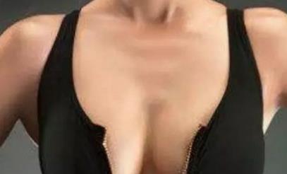 重慶脂肪填充眼睛細紋醫(yī)生