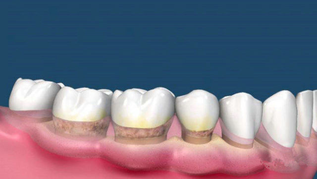 長(zhǎng)沙激光溶脂瘦臀醫(yī)生