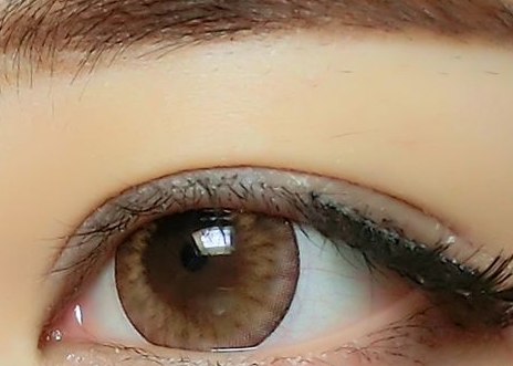 信陽(yáng)玻尿酸去眼底紋醫(yī)生