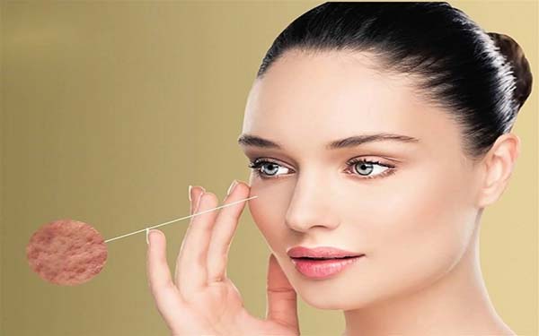 鄭州光電去動態(tài)細紋醫(yī)生