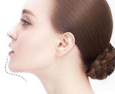 長(zhǎng)沙玻尿酸填充眼角紋醫(yī)生