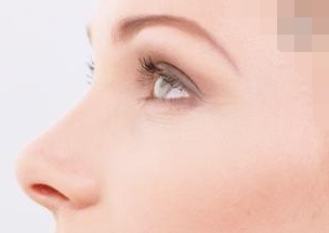 西安頸部皺紋打活細胞醫(yī)生