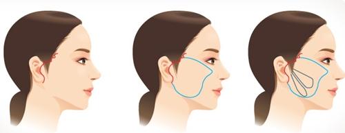 2023商丘哪家醫(yī)院最有效祛疤？排行榜前五精選！驚艷口碑，達(dá)人力薦！