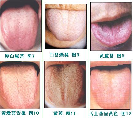 通遼下眼袋吸脂肪醫(yī)生