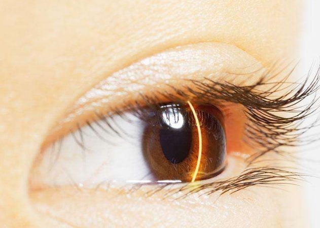 青島膠原蛋白填充鼻部醫(yī)生