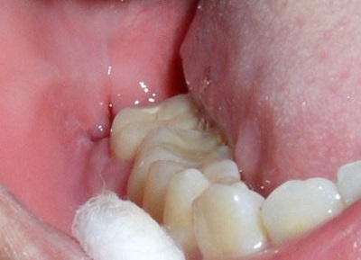 2023南寧地區(qū)五家頂尖牙科醫(yī)院排名揭曉，備受贊譽(yù)！