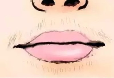 2023年上海七家面部抽脂?？漆t(yī)院一覽