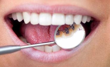 秦皇島眼角拉皮手術(shù)醫(yī)生