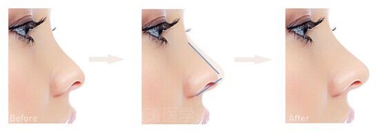 2023北京優(yōu)秀口腔醫(yī)院排行榜：協(xié)和、同仁再獲口碑認(rèn)可！實(shí)力可信賴！