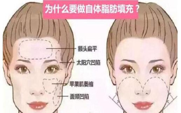 2023全國(guó)頜面整形醫(yī)生排名榜單發(fā)布！這些專家醫(yī)生值得關(guān)注