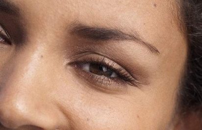 2023山西省脫疤權(quán)威醫(yī)院匯總 Top5，低價高效無憂祛疤！