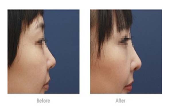 2023年鄭州最佳拉皮手術(shù)醫(yī)院盤點(diǎn)：排名靠前、聲譽(yù)卓越，備受追捧的美容圣地！