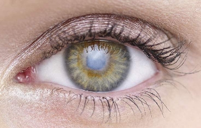 2023年廣州市頭發(fā)移植醫(yī)院排行榜：最好的醫(yī)院居首，引領新潮流！