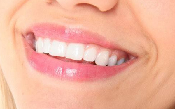 2023年西安牙齒整形醫(yī)院好口碑評價匯總，推薦前五家【價目表附】