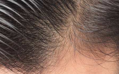 2023年棗莊去眼袋醫(yī)院排行榜最新整理，公立醫(yī)院與私立醫(yī)院綜合評價對比!