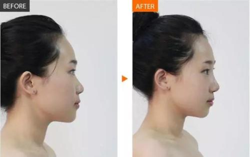 2023年成都做鼻部整形手術(shù)的專家名單公布，了解最可靠的整形醫(yī)生！