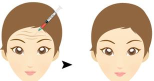 2023年漳州五家靠譜祛疤醫(yī)院及最新收費(fèi)一覽