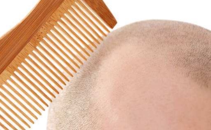 2023年南京口腔矯正醫(yī)院排行榜公布！這三家醫(yī)院上榜了！